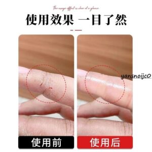 手指防裂貼怎麼用？透明防水指套使用方法、適合情境一次看懂