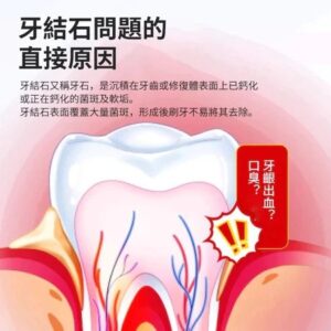 牙結石噴霧 vs. 牙膏/漱口水：你該選哪一種？（以黑黃牙、茶漬、口臭為核心）