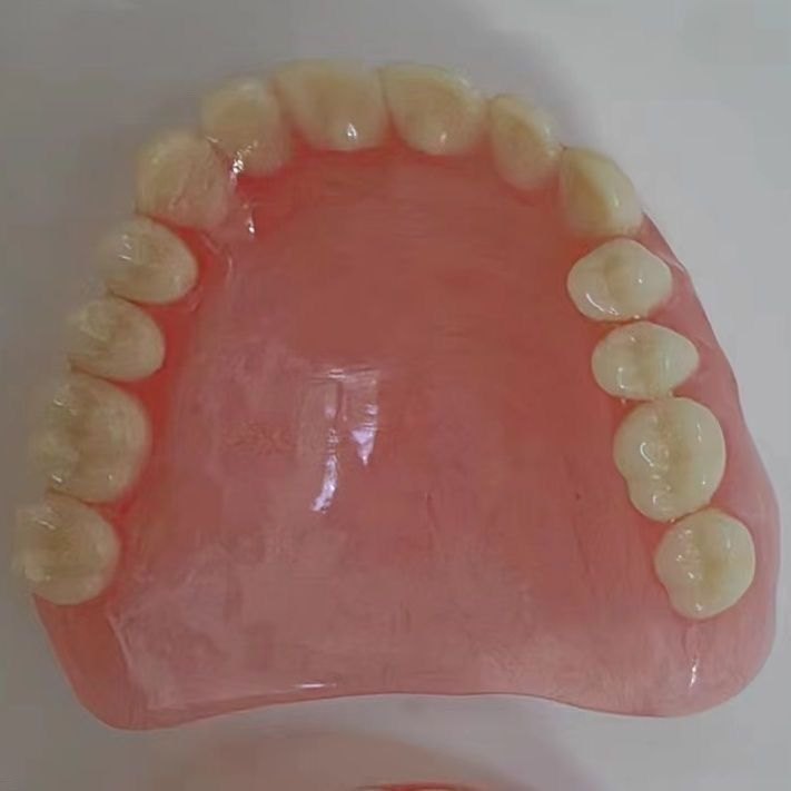 口腔模型側面觀察