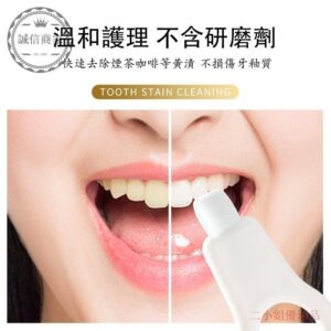 牙漬越刷越覺得「卡住」？用潔牙器 潔牙擦海綿解決你最常遇到的 4 種狀況