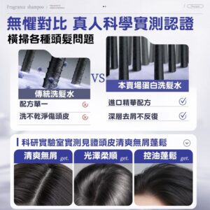 頭皮癢、屑屑反覆、隔天又油:用控油去屑+保濕護髮的方式把循環打斷